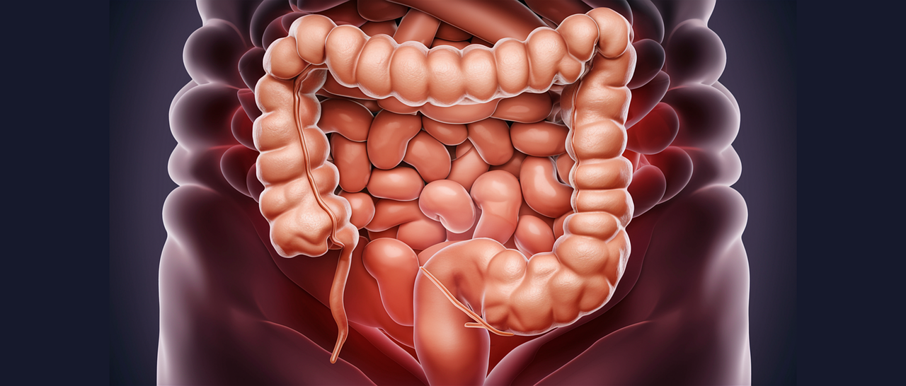 Diagrama del colon